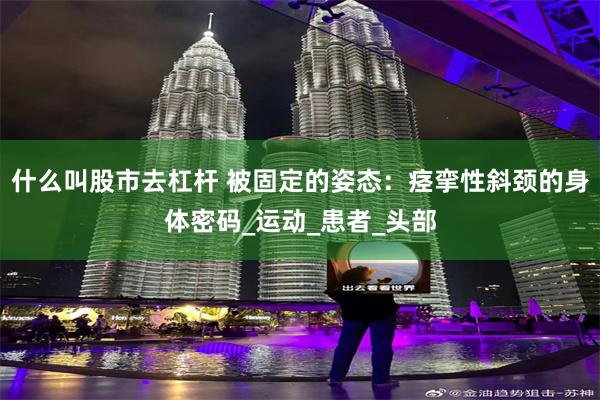 什么叫股市去杠杆 被固定的姿态：痉挛性斜颈的身体密码_运动_患者_头部